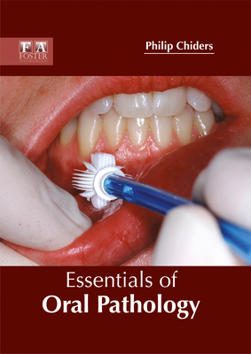 Essentials of Oral Pathology - Chiders, Philip (Editor)