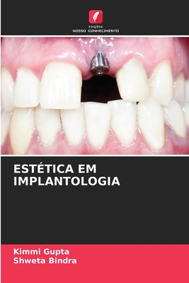 Est?tica Em Implantologia - Gupta, Kimmi, and Bindra, Shweta