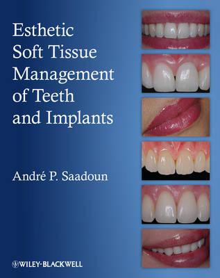 Esthetic Soft Tissue Management of Teeth and Implants - Saadoun, Andre P.