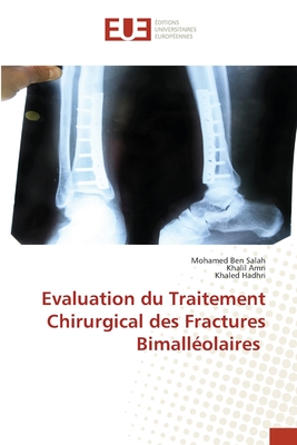 Evaluation du Traitement Chirurgical des Fractures Bimall?olaires - Ben Salah, Mohamed, and Amri, Khalil, and Hadhri, Khaled