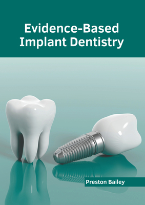 Evidence-Based Implant Dentistry - Bailey, Preston (Editor)