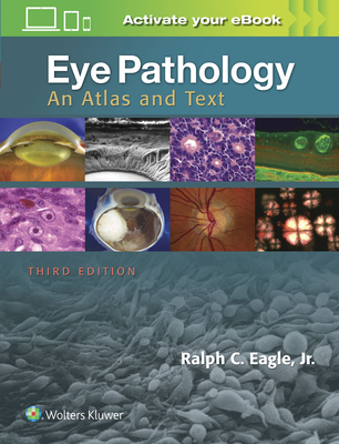 Eye Pathology: An Atlas and Text - Eagle, Ralph C, MD