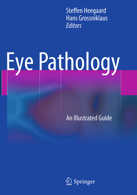 Eye Pathology: An Illustrated Guide - Heegaard, Steffen (Editor), and Grossniklaus, Hans (Editor)