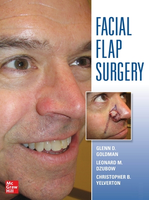 Facial Flaps Surgery - Goldman, Glenn