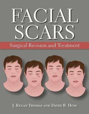 Facial Scars: Surgical Revision and Treatment - Thomas, J. Regan, and Hom, David B.