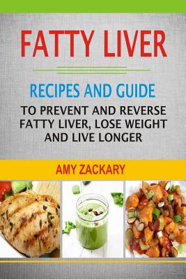 Fatty Liver: Recipes And Guide To Prevent And Reverse Fatty Liver, Lose Weight And Live Longer - Zackary, Amy