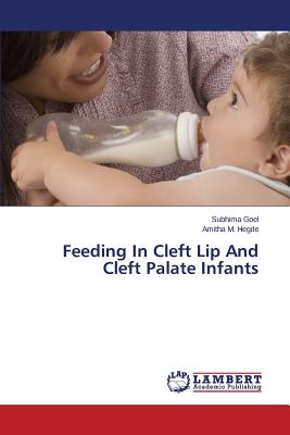 Feeding In Cleft Lip And Cleft Palate Infants - Goel Subhima, and Hegde Amitha M