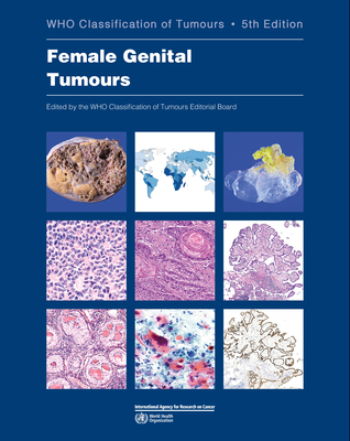 Female Genital Tumours: Who Classification of Tumours - Who Classification of Tumours Editorial Board (Editor)