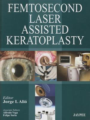 Femtosecond Laser Assisted Keratoplasty - Alio, Jorge L