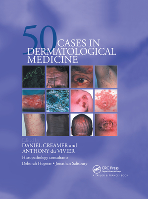 Fifty Dermatological Cases - Creamer, Daniel, and du Vivier, Anthony