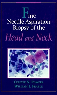 Fine Needle Aspiration Biopsy of the Head and Neck - Powers, Celeste N, and Frable, William