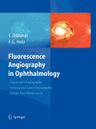 Fluorescence Angiography in Ophthalmology