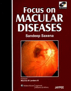 Focus on Macular Diseases - Saxena, Sandeep (Editor)