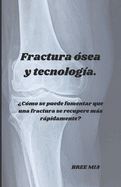 Fractura ?sea y tecnolog?a.: ?C?mo se puede fomentar que una fractura se recupere ms rpidamente?