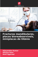 Fracturas mandibulares, placas bioreabsorvveis, miniplacas de titnio