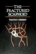 Fractured Scaphoid