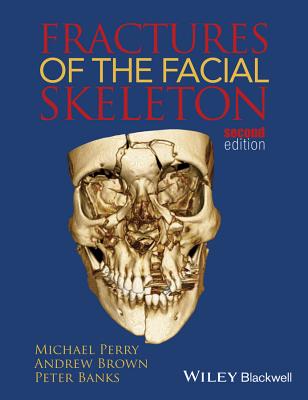 Fractures of the Facial Skeleton - Perry, Michael, and Brown, Andrew, and Banks, Peter