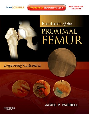 Fractures of the Proximal Femur: Improving Outcomes: Expert Consult: Online and Print - Waddell, James P