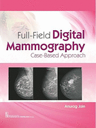 Full-Field Digital Mammography: Case-Based Approach