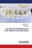 Full Mouth Rehabilitation with Fixed Partial Dentures