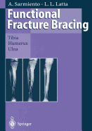 Functional Fracture Bracing: Tibia, Humerus, and Ulna