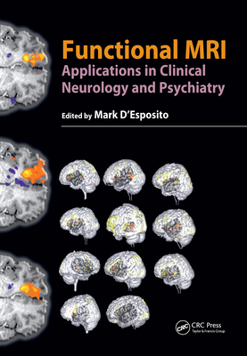 Functional MRI: Applications in Clinical Neurology and Psychiatry - D'Esposito, Mark, M.D. (Editor)