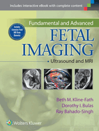 Fundamental and Advanced Fetal Imaging: Ultrasound and MRI