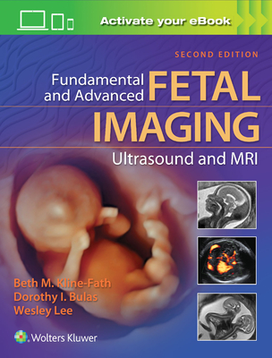 Fundamental and Advanced Fetal Imaging Ultrasound and MRI - Kline-Fath, Beth, MD, and Bulas, Dorothy, Dr., MD, and Lee, Wesley
