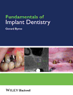Fundamentals of Implant Dentistry - Byrne, Gerard