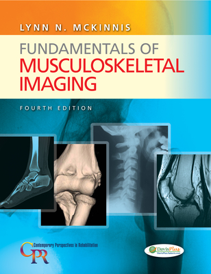 Fundamentals of Musculoskeletal Imaging - McKinnis, Lynn N