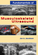 Fundamentals of Musculoskeletal Ultrasound: Expert Consult- Online and Print
