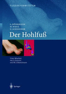 Fussdeformitaten: Der Hohlfuss