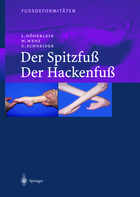 Fussdeformitaten: Der Spitzfu / Der Hackenfu - Dvderlein, L, and Wenz, W, and Schneider, Urs