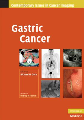 Gastric Cancer - Gore, Richard M. (Editor)