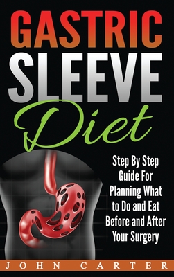 Gastric Sleeve Diet: Step By Step Guide For Planning What to Do and Eat Before and After Your Surgery - Carter, John
