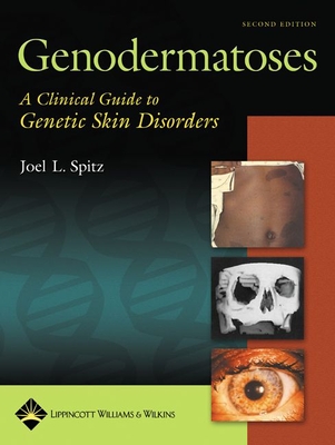 Genodermatoses: A Clinical Guide to Genetic Skin Disorders - Spitz, Joel L, MD (Editor)