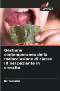 Gestione contemporanea della malocclusione di classe III nel paziente in crescita