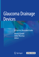 Glaucoma Drainage Devices: A Practical Illustrated Guide