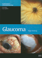 Glaucoma - Hitchings, Roger Alan (Editor), and Lightman, Susan (Editor)