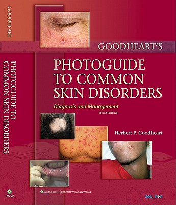 Goodheart's Photoguide to Common Skin Disorders: Diagnosis and Management - Goodheart, Herbert P, MD