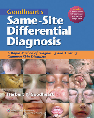 Goodheart's Same-Site Differential Diagnosis: A Rapid Method of Diagnosing and Treating Common Skin Disorders - Goodheart, Herbert P, MD