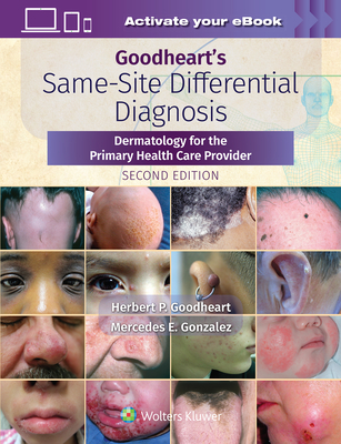 Goodheart's Same-Site Differential Diagnosis: Dermatology for the Primary Health Care Provider - Goodheart, Herbert