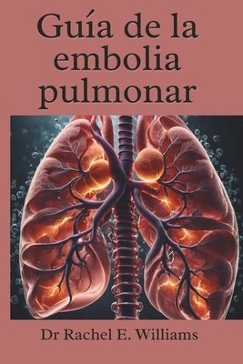 Gua de la embolia pulmonar - Williams, Rachel E, Dr.