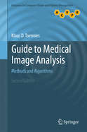 Guide to Medical Image Analysis: Methods and Algorithms