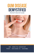 Gum Diseases Demystified: Doctor's Secret Guide