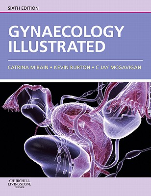 Gynaecology Illustrated - Bain, Catrina, and Burton, Kevin, MD, and McGavigan, Jay, MD