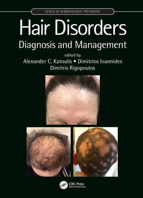 Hair Disorders: Diagnosis and Management - Katoulis, Alexander C (Editor), and Ioannides, Dimitrios (Editor), and Rigopoulos, Dimitris (Editor)