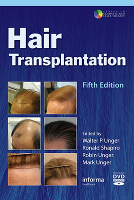 Hair Transplantation - Unger, Walter (Editor), and Shapiro, Ronald (Editor), and Unger, Robin (Editor)
