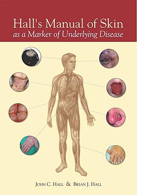 Hall's Manual of Skin as a Marker of Underlying Disease - Hall, John C, MD