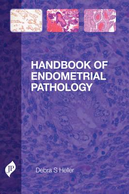 Handbook of Endometrial Pathology - Heller, Debra S.